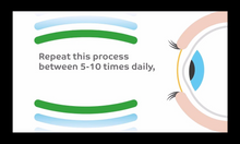 Load image into Gallery viewer, Eyepeace - Eyelid massager - Dr. Shalu Pal Optometrist